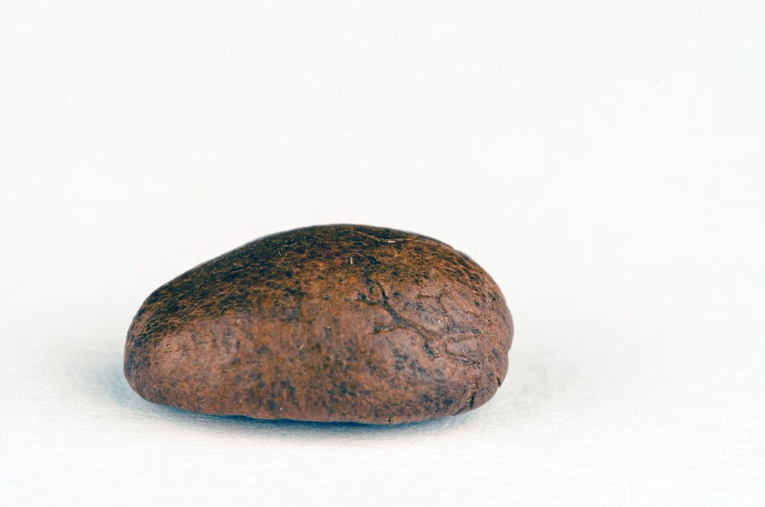 Kidney Stones and the Protein on Your Plate